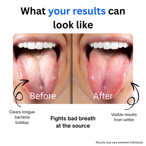 Breath & Bliss™ Oral Probiotic